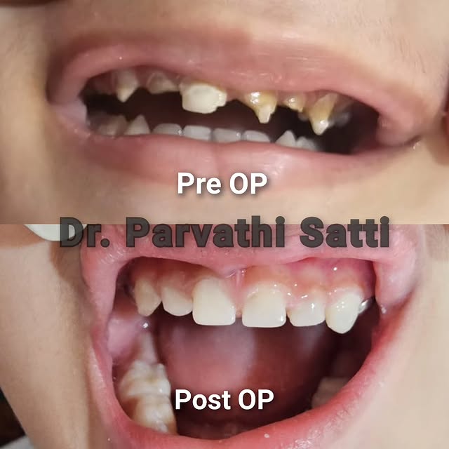 489990443_1710815492851771_2344561174555977583_n.