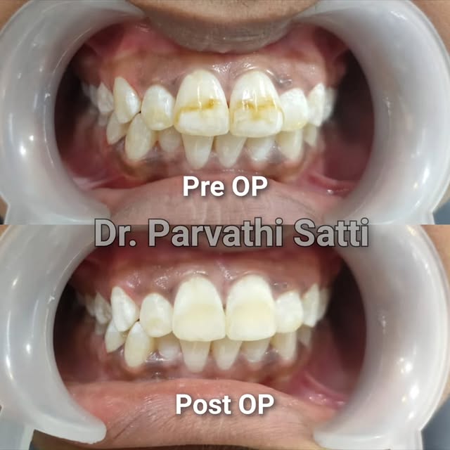 530875303_1406067390679324_4175677671572122951_n.