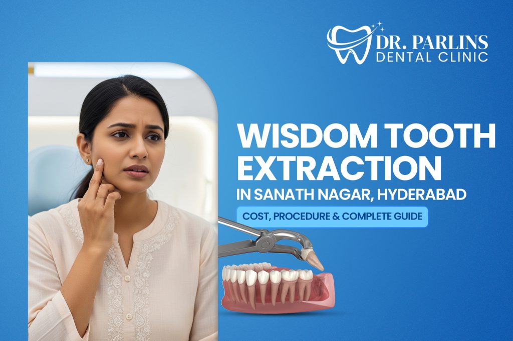 Wisdom Tooth Extraction in Sanath Nagar