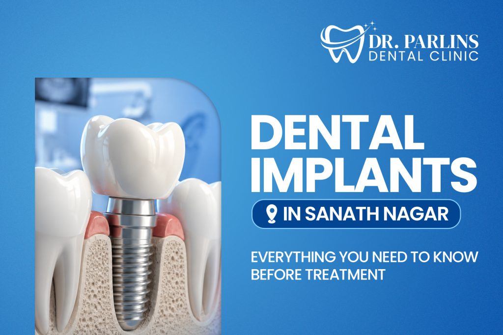 Dental Implants in Sanath Nagar