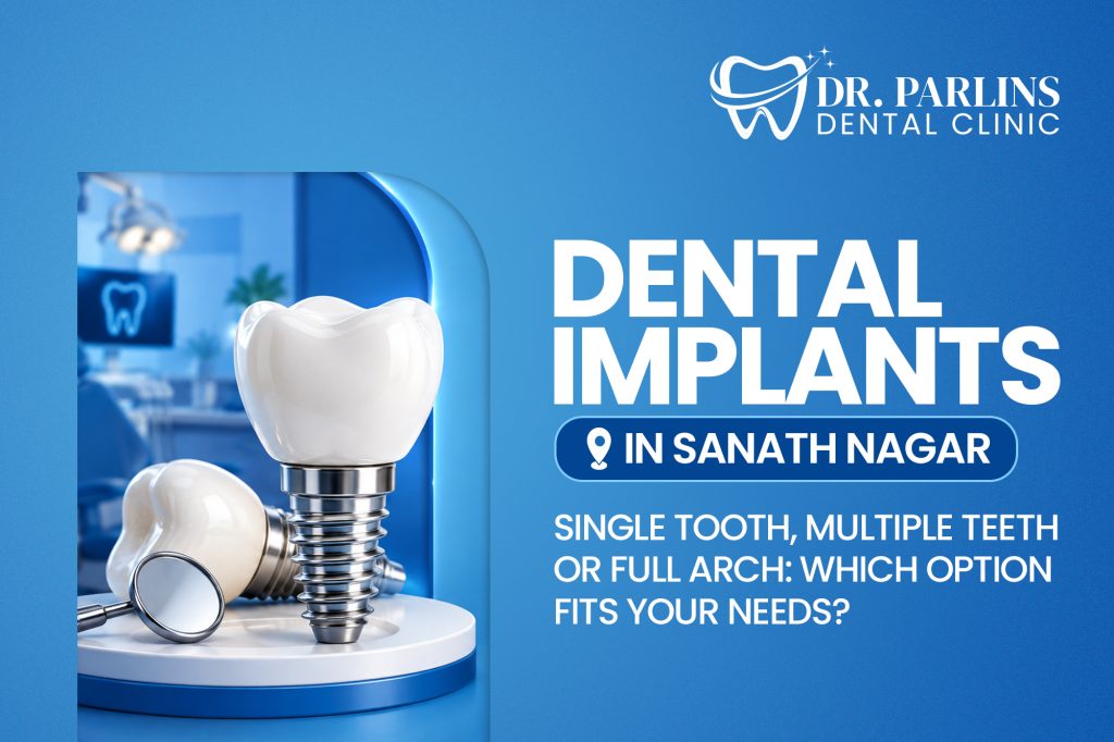 Dental Implants in Sanath Nagar