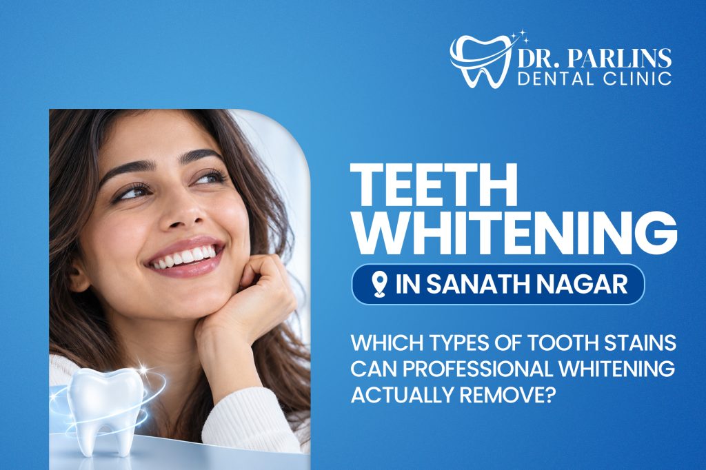 Teeth Whitening in Sanath Nagar