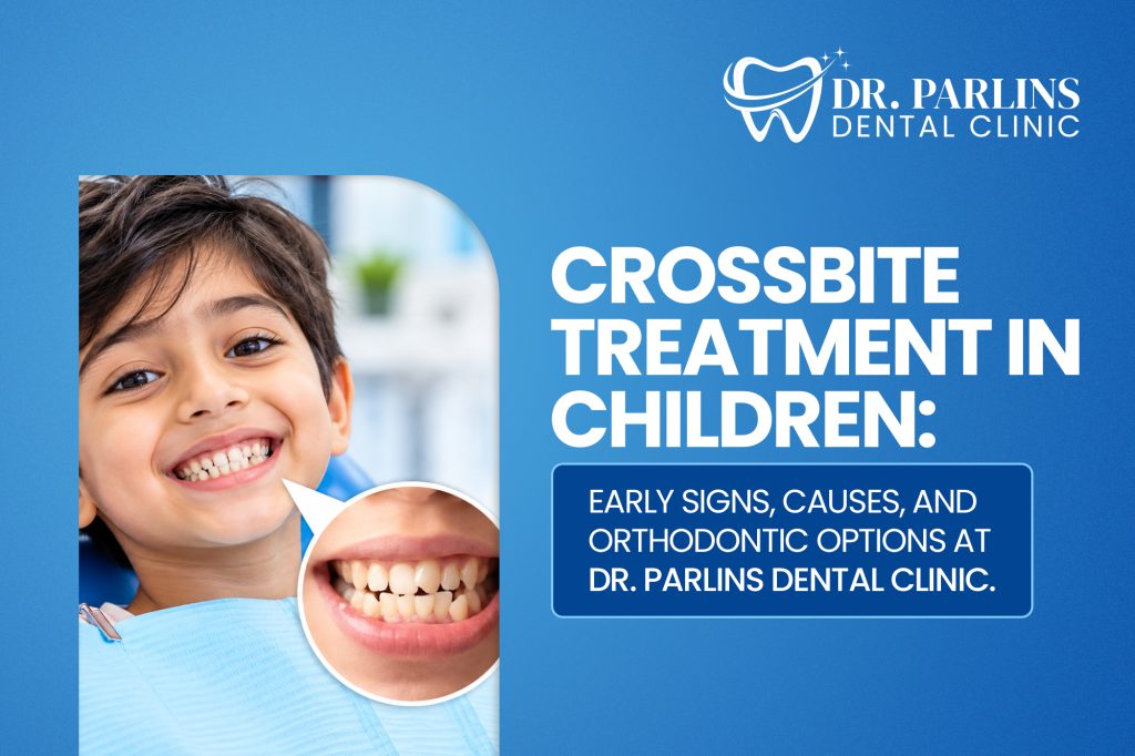 Crossbite Treatment in Children